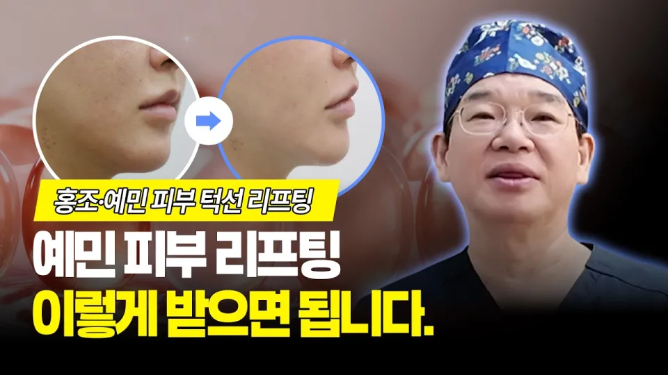 5가지 예민피부 리프팅 시술 방법과 주의사항
