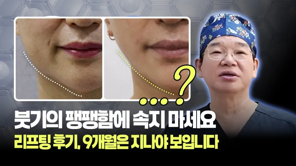 리프팅시술은 어떻게 진행되고 효과는 언제부터 나타나는가